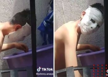 Le encargan hacer máscara de yeso y se le queda pegada