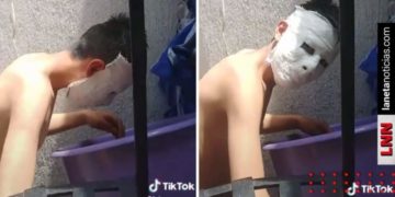 Le encargan hacer máscara de yeso y se le queda pegada
