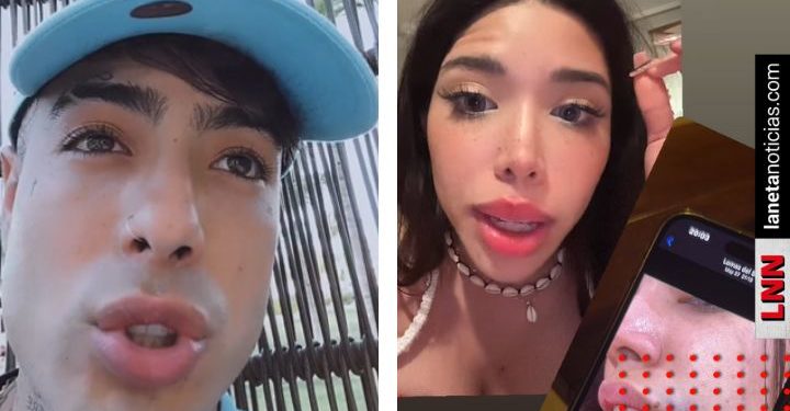 Yei MUA exhibe huellas de maltrato de Naim Darrechi