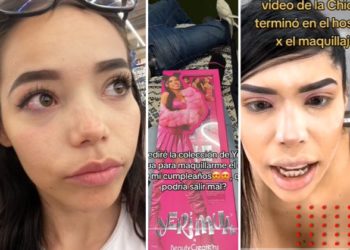 Joven compra maquillaje de Yeri MUA y termina en el doctor