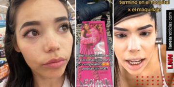 Joven compra maquillaje de Yeri MUA y termina en el doctor