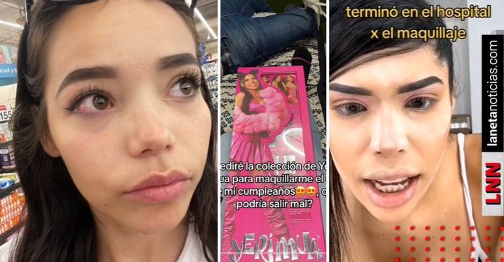 Joven compra maquillaje de Yeri MUA y termina en el doctor