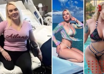 Modelo pierde pierna por contagiarse de bacteria en la playa