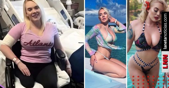 Modelo pierde pierna por contagiarse de bacteria en la playa