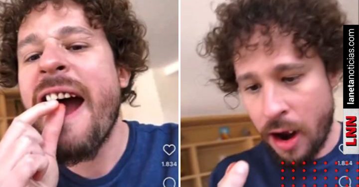 Luisito Comunica se saca los dientes en pleno live (VIDEO)